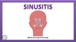 SINUSITIS  RHINOSINUSITIS  Acute amp Chronic Sinusitis  Pathophysiology  The Nurses Station [upl. by Egdirdle]