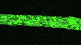 Neurospora organelle structuremov [upl. by Oletha513]