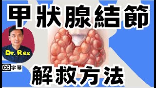 如何改善甲狀腺結節？ 什麼病徵顯示甲狀腺結節是腫瘤？ [upl. by Barmen]