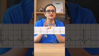 How To Read A ECG Rhythm shorts ecg ecginterpretation nclex [upl. by Averill]