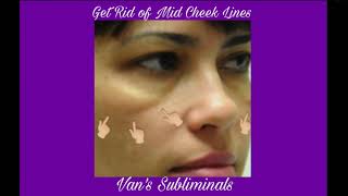 Get Rid of Mid Cheek Lines  Subliminal request [upl. by Natye]