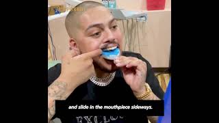 AporroHow to molding your Grillz by yourself [upl. by Fraser]