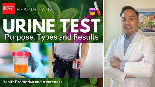 Urinalysis Urine Test What it is types purpose and results [upl. by Odo165]