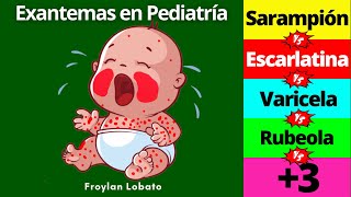 Exantemas en Pediatría ¡Fácil y completo👶 Escarlatina Sarampión Rubeola Varicela Kawasaki etc [upl. by Anair]