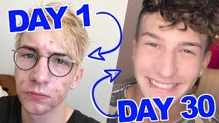 CLEAR ACNE SCARS FAST  DIY Face Masks That WORK [upl. by Estevan261]