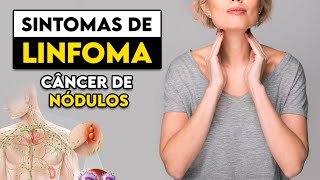 TOME CUIDADO Estes são os sinais e sintomas do LINFOMA │ Médico Explica [upl. by Hey]