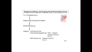 Diagnosestellung und Staging beim Prostatakarzinom  Strahlentherapie Prof Hilke Vorwerk [upl. by Odrude]