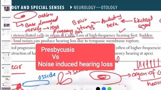 presbycusis Vs noise induced hearing loss otorhinolaryngology 4  First Aid USMLE Step 1 in Urdu [upl. by Mcleod]