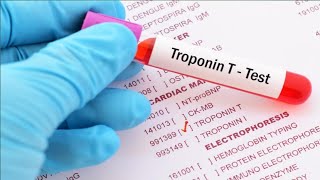 How To Maintain Normal Troponin Levels [upl. by Omik24]