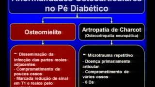 Osteomielite no pé diabético Diagnóstico por imagem [upl. by Khalil]