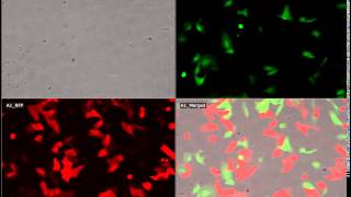 JuLI Stage Application Video U2 OS cell GFP and RFP expression [upl. by Gaige361]