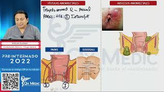 FISTULAS Y ABSCESOS ANORECTALES  QX MEDIC  Cirugía General [upl. by Stimson705]