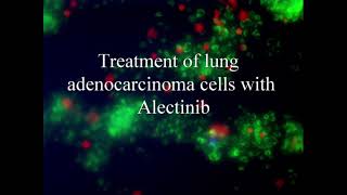 Lung adenoma cells A549 treated with kinase inhibitor Alectinib [upl. by Saxena]