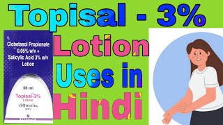 Topisal  3 Lotion Uses in Hindi  Clobetasol Propionate and Salicylic Acid Lotion Uses in Hindi [upl. by Auerbach]