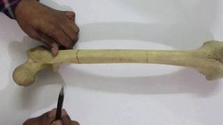 Femur in Bangla [upl. by Asilef]