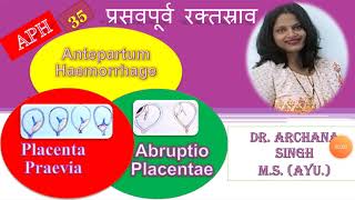 35 APH ANTEPARTUM HAEMORRHAGE  प्रसवपूर्व रक्तस्राव [upl. by Joshi]