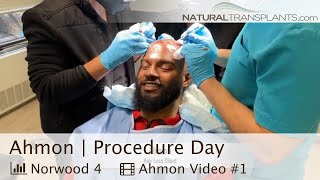 Hair Transplant Procedure For Men An Inside Look  Dr Blumenthal Ahmon [upl. by Aiyot]