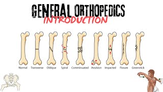 INTRO TO GENERAL ORTHOPEDICSCHP15FRACTURESTYPESAO classification orthopedics shamim dogar [upl. by Webster20]