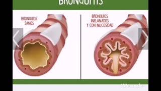 INDICACIONES AZITROMICINA [upl. by Adolphus]