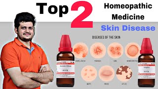 Top 2 Homeopathic Medicine for Skin  चर्म रोग की सबसे बेहतरीन दो होम्योपैथिक दवा [upl. by Lash]