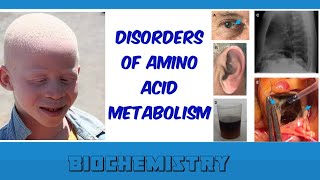 disorders of amino acid metabolism [upl. by Rania856]