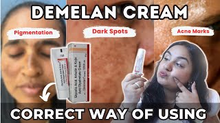 Can We Use Demelan Cream Everyday For Skin Brightening Pharmacy Brightening Cream Demelan [upl. by Sokin298]