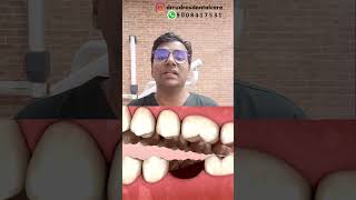 Dr Rudra Why is it necessary to replace lost teeth ASAPmissingteeth teethreplacement dentistry [upl. by Aicatsal291]