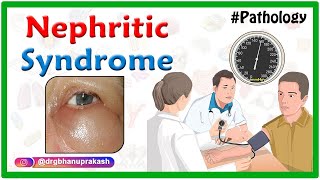 Nephrotic Syndrome vs Glomerulonephritis  Nephritic vs Nephrotic Syndrome Nursing NCLEX [upl. by Ainolloppa]