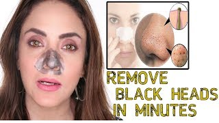 Home Made Blackheads Removing Strip  Remove From Nose Instantly [upl. by Merth]