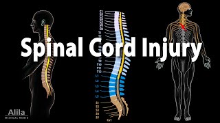 Spinal Cord Injury Animation [upl. by Ruff]