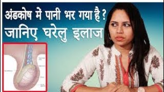 Hydrocele Ka Desi Gharelu Ilaj │ आपके अंडकोष में पानी भर गया हो तो जानिए घरेलु इलाज │ Life Care [upl. by Hellene207]