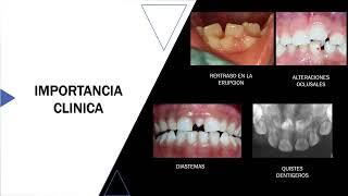 ANOMALIAS DENTARIAS [upl. by Georgine171]