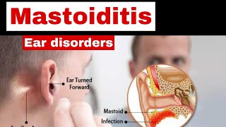 mastoiditis in hindi  cause symptoms surgery nursing care  ear disorders nursing  ent [upl. by Ajad897]