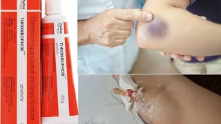 Thrombophob ointment  Treatment ofThrombosis  Superficial Blood Clotting  medicine information [upl. by Alinna]