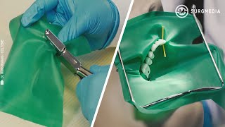 Basics of Dental Rubber Dam Placement [upl. by Peh]