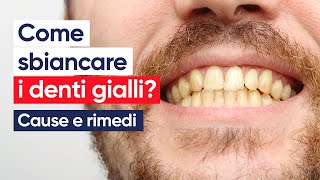 Come sbiancare i denti gialli Cause e rimedi [upl. by Vez336]