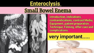 Small Bowel Enema  Enteroclysis  small bowel enema procedure  Barium Enema enteroclysis 2024 [upl. by Killion]