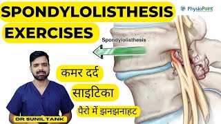 Spondylolisthesis Exercises  Spondylolisthesis physiotherapy treatment  L4L5 L5S1  Sciatica [upl. by Ekihc]