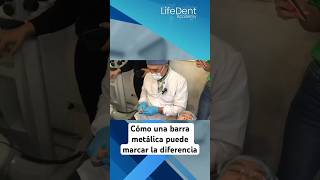 prostodoncia dentista protesisdental protesisdentales protesista [upl. by Asiuqram]