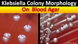 Klebsiella Colony Morphology On Blood Agar [upl. by Neidhardt]