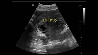 Extended  Rapid Ultrasound for Shock and Hypotension [upl. by Inaflahk]