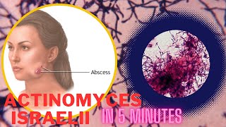 actinomyces microbiology lecture actinomyces israelii Easy Microbiology [upl. by Arriek]