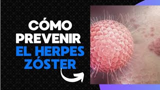 quotCómo prevenir el Herpes Zóster y evitar el dolor crónicoquot [upl. by Nynnahs]