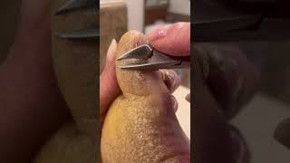 ASMR Toe Maintenance Clipping with Hyperkeratosis EPPK foot callus Keratoderma  May 23 2023 [upl. by Skier]