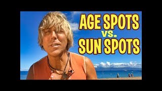 AGE SPOTS or SUN SPOTS on Skin How to Get Rid of Them [upl. by Amathiste]