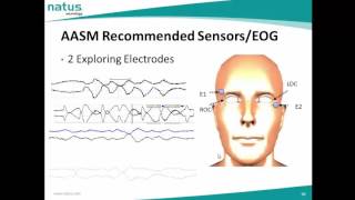 AASM Recommended and Alernative sensors in PSG [upl. by Nalyad]