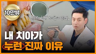 치아미백 딴짓말고 이렇게만 하세요  서울대출신 치과의사가 알려주는 치아미백의 모든것 [upl. by Alien468]