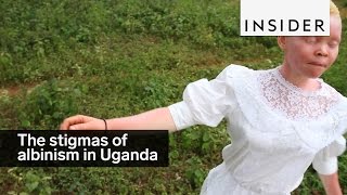 This man is fighting the stigmas of albinism in Uganda [upl. by Eohce]