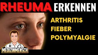 Rheuma Symptome von Arthritis Fieber Polymyalgia Rheumatica Rheumatologe erklärt [upl. by Coco]