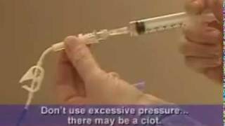 Broviac Catheter Care Videos Flush the Catheter [upl. by Ithsav550]